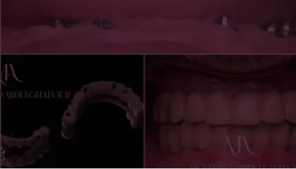 Clinical Cases